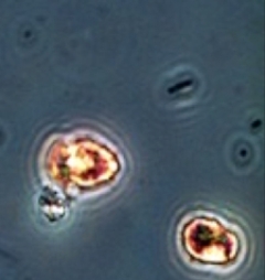 Heterocapsa rotundata, a species of phytoplankton 