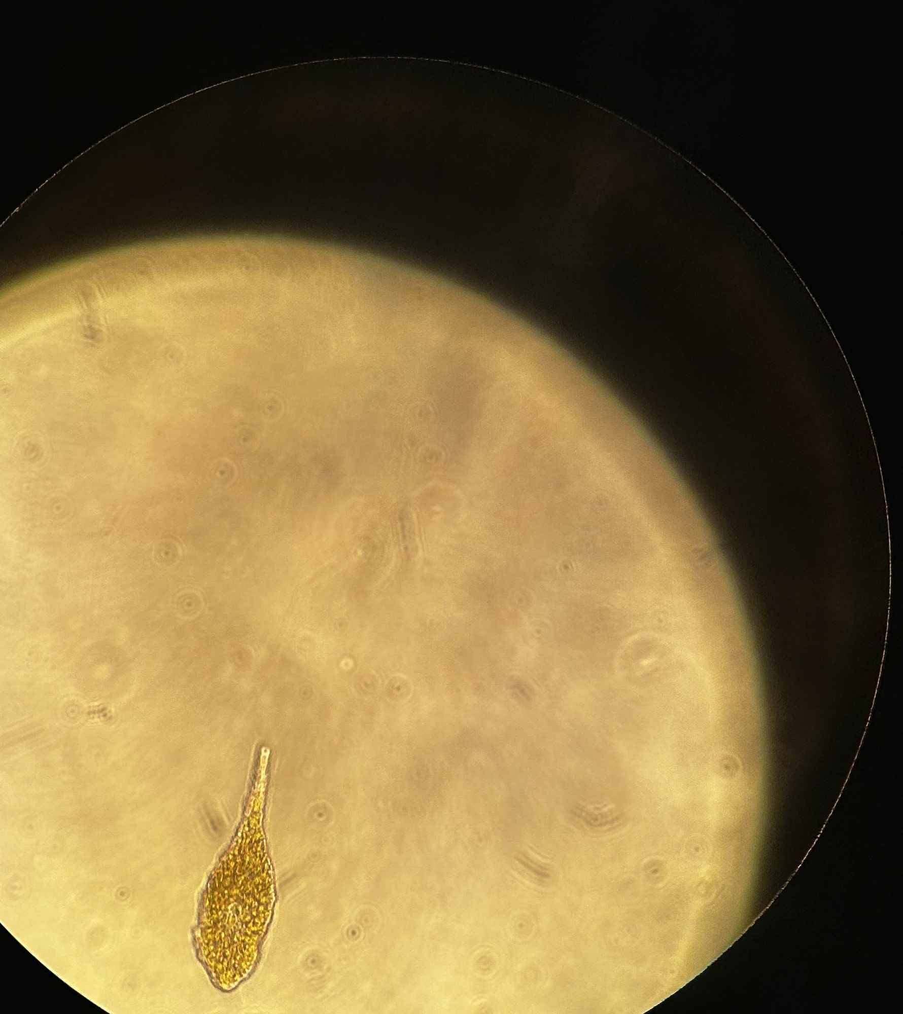 Chattonella antiqua under a microscope.